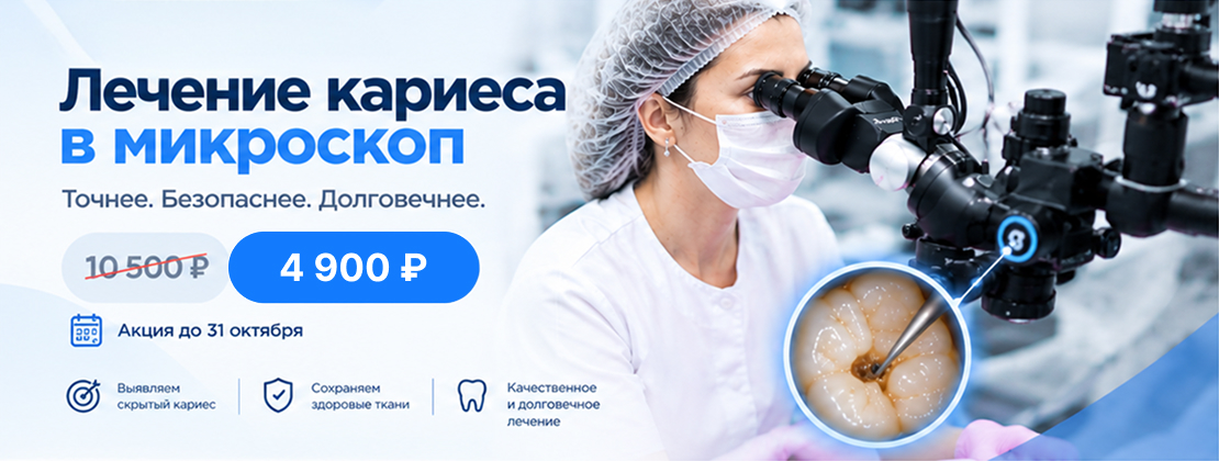 Лечение кариеса в микроскоп по акции
